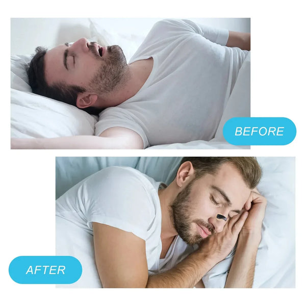 NasalMag™ Breathing Aid
